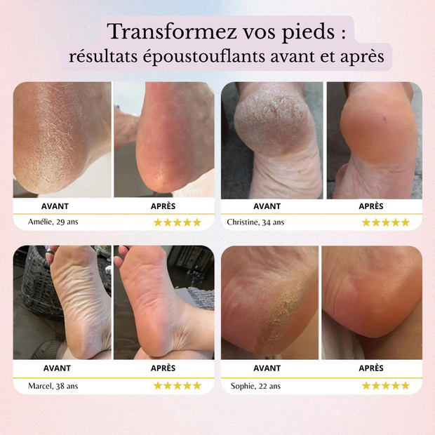 NurAmor Pro™ - Râpe électrique